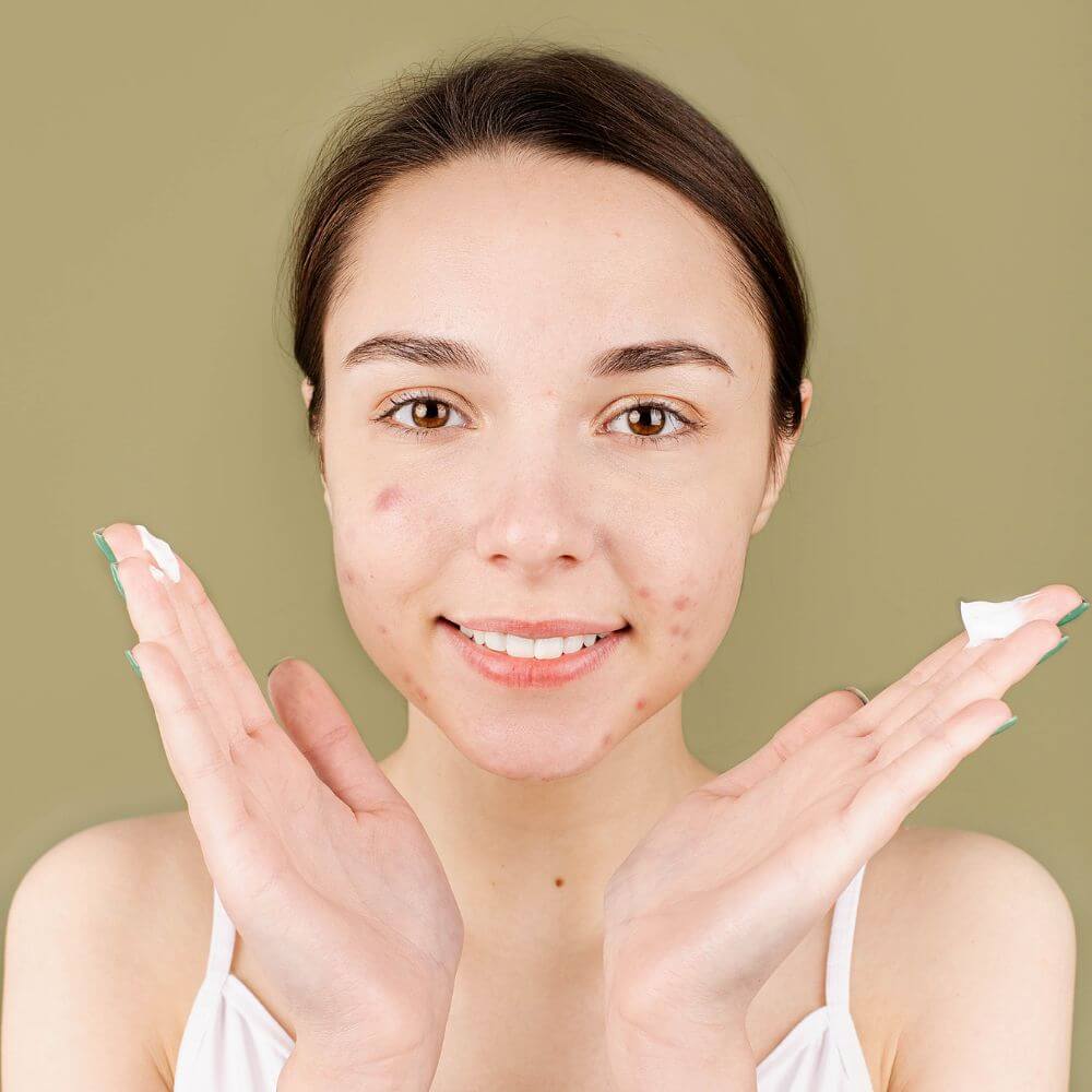 The Best Primers to Disguise Your Acne Scars Get a Flawless Finish!